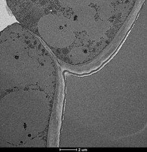 Electron microscopy